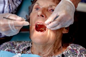 In Home Dental Care Aliso Viejo