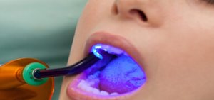 Mobile Dentistry Services