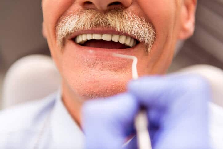 Elderly man getting his teeth cleaned - Mobile dentistry services for seniors in Sonoma County and Marin County